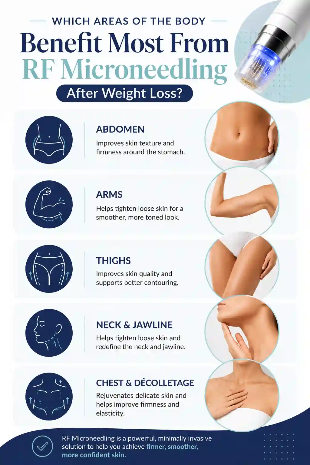 Which Areas of the Body Benefit Most From RF Microneedling After Weight Loss Wokingham